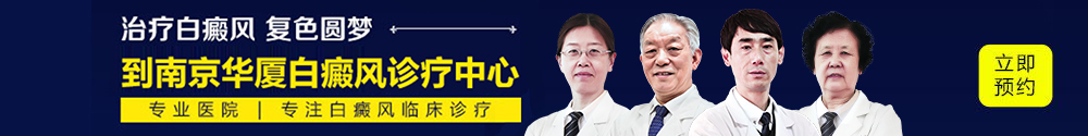白癜风医院哪家好